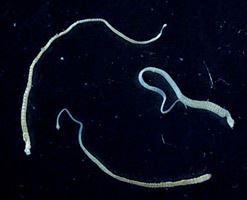 Man Killed by His Tapeworm's Cancer