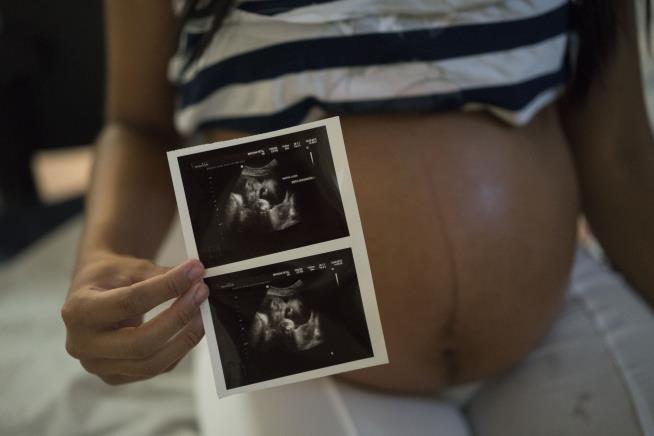 3 Pregnant Women in Florida Have Zika