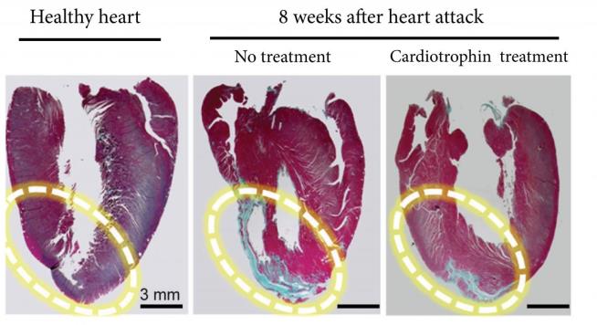 'Exciting' Find Could Mean Fewer Heart Transplants
