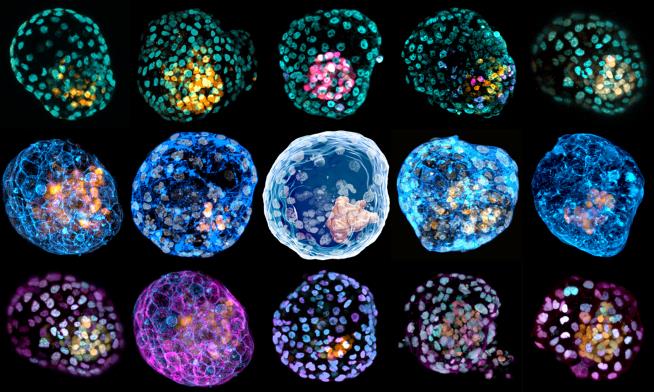 Lab-Made 'Pre-Embryos' Could Revolutionize Research