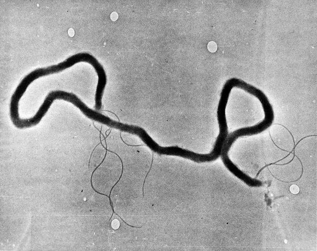 Province Sees 'Horrifying' Number of Syphilis Infections