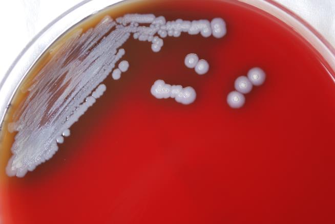 Deadly Bacterium Found in US Soil