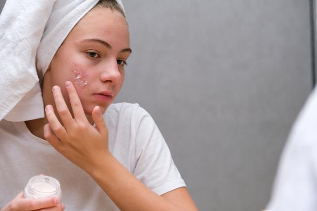 There May Be Carcinogen in Your Acne Cream
