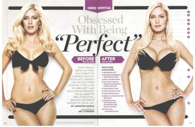 Heidi Montag, Before and After