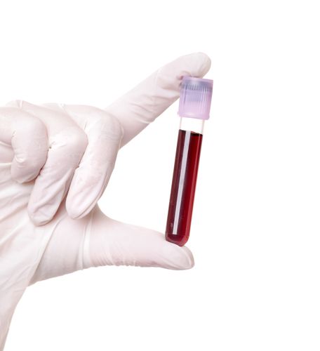 New Blood Test Checks for Depression