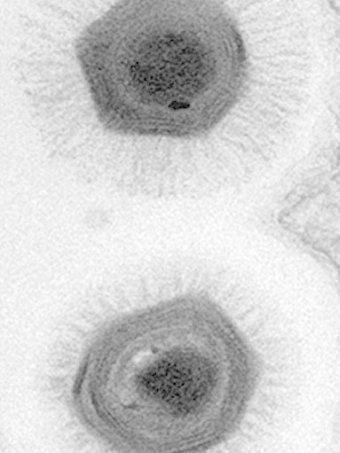 'Megavirus' Found Off Chile Coast