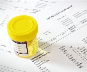 Welfare Drug Tests Cost Florida $46K