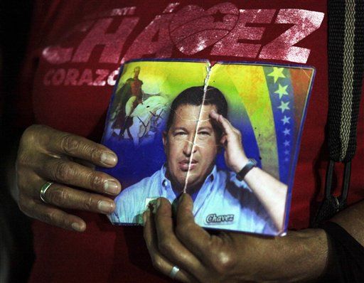 Hugo Chavez Suffers Complications From Surgery
