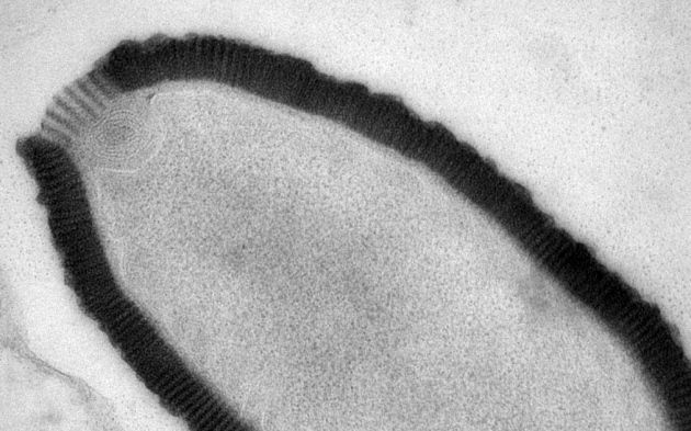 Giant Virus Revives After 30,000 Years