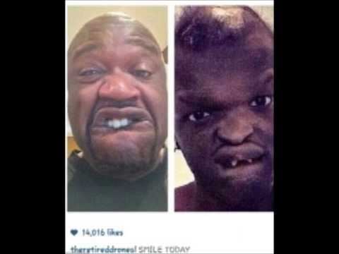 Man With Disorder Sues Shaq for Mocking His Selfie