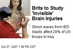 Brits to Study 'Invisible' Brain Injuries
