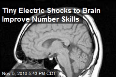 Tiny Electric Shocks to Brain Improve Number Skills