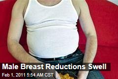 Male Breast Reductions Swell