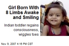 Girl Born With 8 Limbs Awake and Smiling