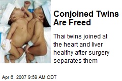 Conjoined Twins Are Freed