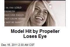 Model Hit by Propeller Loses Eye
