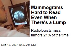 Mammograms Hard to Read Even When There's a Lump