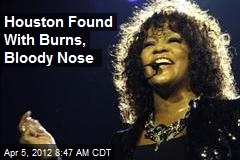 Houston Found With Burns, Bloody Nose
