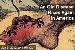 An Old Disease Rises Again in America