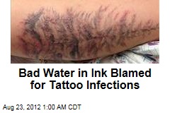 Bad Water in Ink Blamed for Tattoo Infections