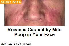 Rosacea Caused by Mite Poop in Your Face