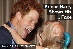 Prince Harry Shows His ... Face