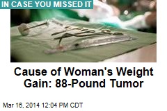 Cause of Woman&#39;s Weight Gain: 88-Pound Tumor