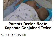 Parents Decide Not to Separate Conjoined Twins