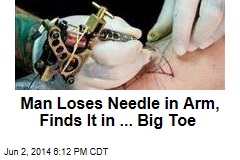Man Loses Needle in Arm, Finds It in ... Big Toe