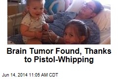 Brain Tumor Found, Thanks to Pistol-Whipping