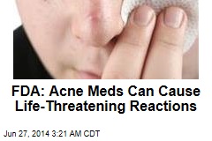 FDA Warns of Severe Acne Product Reactions