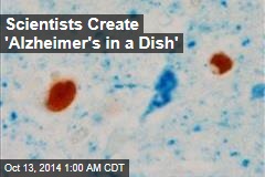 Scientists Create &#39;Alzheimer&#39;s in a Dish&#39;