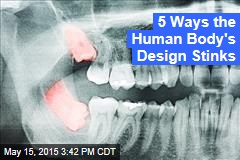 5 Ways the Human Body&#39;s Design Stinks