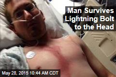 Man Survives Lightning Bolt to the Head
