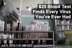 $25 Blood Test Finds Every Virus You&#39;ve Ever Had