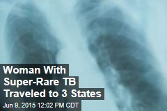 Woman With Super-Rare TB Traveled to 3 States