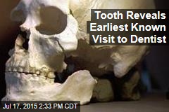 Tooth Reveals Earliest Known Visit to Dentist