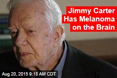 Jimmy Carter Has Melanoma on the Brain