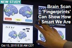Brain Scan &#39;Fingerprints&#39; Can Show How Smart We Are