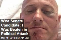 WVa Senate Candidate: I Was Beaten in Political Attack