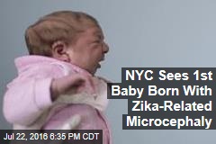NYC Sees 1st Baby Born With Zika-Related Microcephaly