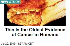 This Is the Oldest Evidence of Cancer in Humans