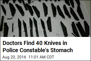 Doctors Find 40 Knives in Police Man&#39;s Stomach