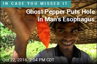 Ghost Pepper Puts Hole in Man&#39;s Esophagus