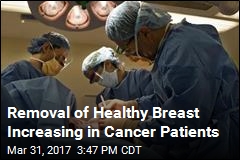 More Breast Cancer Patients Are Removing Healthy Breast
