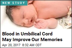 Umbilical Cord Blood May Give Boost to Aging Brain