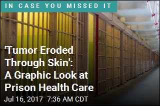 &#39;Tumor Eroded Through Skin&#39;: A Graphic Look at Prison Health Care