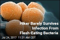 Hiker Barely Survives Infection From Flesh-Eating Bacteria