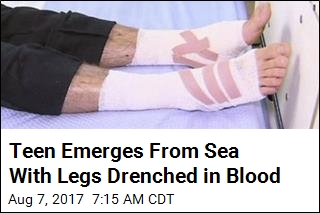 Teen Emerges From Sea With Legs Drenched in Blood