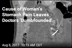 Cause of Woman&#39;s Stomach Pain Leaves Doctors &#39;Dumbfounded&#39;